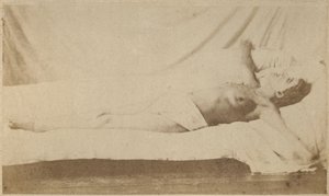 Epilepsja histeryczna, atak, ukrzyżowanie, płyta VI z "Iconographie Photographique de La Salpetriere" Bourneville et P. Regnard, Paryż, 1876 (odbitka albuminowa)