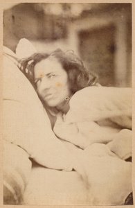 Epilepsja histeryczna, majaczenie, pożądanie, płyta XXXVI z „Iconographie Photographique de La Salpetriere” Bourneville