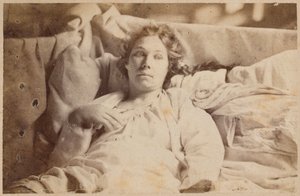 Epilepsja histeryczna, faza terminalna, majaczenie melancholijne, ilustracja z „Iconographie Photographique de La Salpetriere” Bourneville i P. Regnard, płyta XIX, Paryż, 1876 (druk albumowy)
