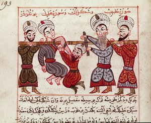 Medycyna: interwencja ortopedyczna. Miniatura zaczerpnięta z dojenia tureckiej medycyny przez Charaf-ed-din (Charaf ed Din) (1404-1468) po „”La Surgery Imperiale”” (Ms Sup Turk 693 fol. 193) 1466 Paris, B.N. autorstwa Persian School