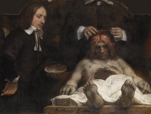 Lekcja anatomii dr Jana Deymana, 1656 autorstwa Rembrandt van Rijn