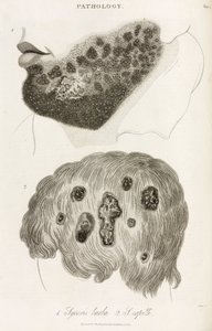 Dermatologia Choroby skóry autorstwa John Pardon