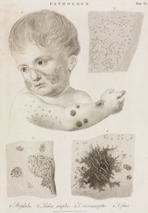 Dermatologia Rodzaje chorób skóry autorstwa John Pardon