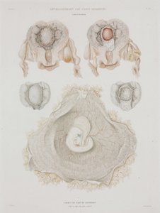 Ginekologia Ludzka macica z zarodkiem, ok. 1847-1859 autorstwa John Pardon