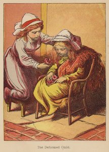 Zdeformowane dziecko (kolorowa rycina)