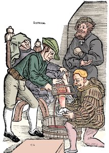 Amputacja nogi bez znieczulenia, 1593 autorstwa Unbekannt