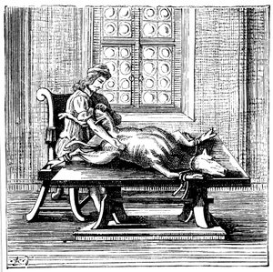 Transfuzja krwi od zwierzęcia do człowieka, 1679 autorstwa Unbekannt