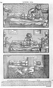 Ilustracja z Awicenny, 1556 autorstwa Unbekannt