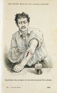 Malowanie rany roztworem antyseptycznym, c1890 autorstwa Unbekannt