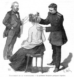 Profesor Bergmann wstrzykuje pacjentowi gruźlicę, 1891 autorstwa Unbekannt