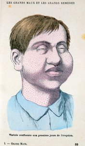 Ofiara ospy, c1890 autorstwa Unbekannt