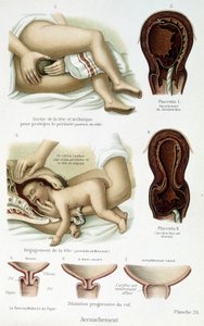Poród - rada naukowa, koniec XIX w. autorstwa Unknown artist