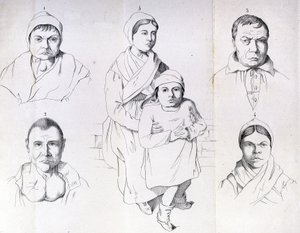 Rozważania nad przyczynami endemicznego kretynizmu Morela. autorstwa Unknown artist