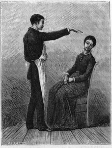 Zjawiska hipnozy: hipnoza powstaje w wyniku nagłego wyciągnięcia ręki przed pacjenta. Grawerowanie z 1881 roku. autorstwa Unknown artist