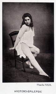 Hystero Epilepsie - Przykurcz w „Ikonografii fotograficznej Salpétrière: służba pana Charcota” autorstwa Paula Regnarda i Bourneville autorstwa Unknown artist