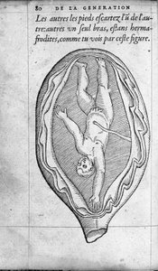 Pozycja płodu w macicy podczas ciąży. Rycina z „De la generation des enfants” autorstwa francuskiego lekarza i chirurga Ambroise Pare (1509-1590) XVI wiek autorstwa Unknown artist