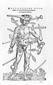 Wszelkiego rodzaju traumatyczne obrażenia wojenne. 16 wiek autorstwa Unknown artist