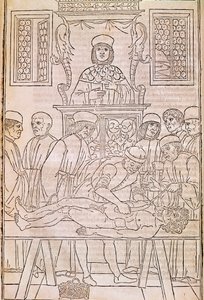 Autopsja. Kodeks. Lekarze rozbiorą ciało martwego mężczyzny w celu zbadania anatomii. „”Fasciculus Medicinae””.Kodeks fascykułu lekarskiego Johannesa Kethana autorstwa Unknown artist