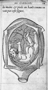 Pozycja płodu w macicy podczas ciąży. Rycina z „De la generation des enfants” autorstwa francuskiego lekarza i chirurga Ambroise Pare (1509-1590) XVI wiek autorstwa Unknown artist