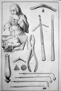 Trepanacja czaszki, różne instrumenty (grawerowanie autorstwa Unknown artist