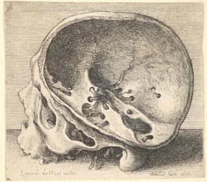 Przekrojona czaszka z profilu w lewo z usuniętą lewą stroną czaszki, 1651. autorstwa Wenceslaus Hollar