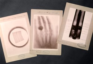 Oryginalne radiogramy Roentgena (radiografia) autorstwa Wilhelm (after) Röntgen