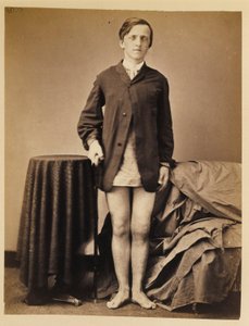 Szeregowy G. W. Warrington, powrót do zdrowia bez amputacji po postrzałowym złamaniu prawej rzepki, z katalogu fotograficznego sekcji chirurgicznej