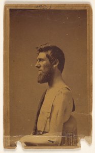 [Niezidentyfikowana ofiara wojny secesyjnej z profilu, siedząca]. autorstwa William H. Bell