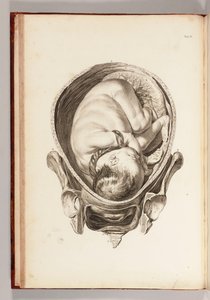 Rycina przedstawiająca dziecko w łonie matki z „Zestawu tablic anatomicznych z objaśnieniami i skrótem praktyki położniczej”, 1754 autorstwa William Smellie