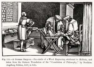 Niemiecki chirurg z Pocieszenia filozofii Boecjusza, ilustracja z Nauki i literatury w średniowieczu i renesansie, napisana i rytowana przez Paula Lacroix, 1878 (bw ph