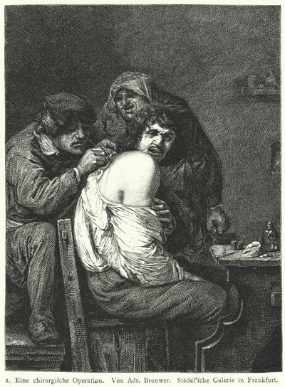 Operacja z tyłu autorstwa Adriaen (after) Brouwer