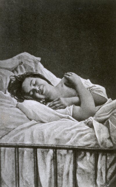 Młoda kobieta w napadzie histerii, 1878 autorstwa Albert Londe