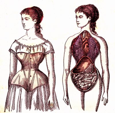 Gorset uciskowy - Normalne życie i zdrowie J. Rengade. Rysunek A. Demarle 1881 autorstwa Alphonse Demarle
