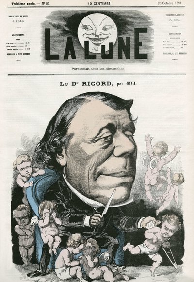Portret doktora Ricorda, francuskiego lekarza. Karykatura Gilla, w „La Lune”, 20 października autorstwa Andre Gill