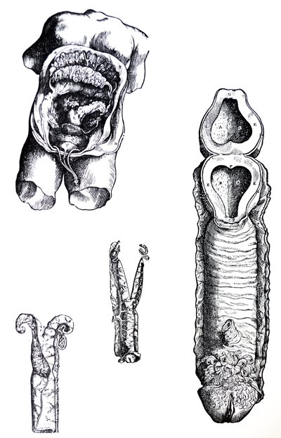 Tablice z V Księgi De Humani Corporis Fabrica autorstwa Andreas Vesalius