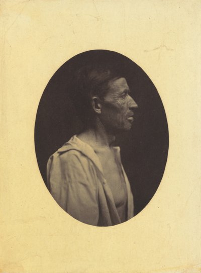 Widziany z profilu portret 42-letniego mężczyzny, oszołomionego nadużywaniem alkoholu..., 1854-1856. autorstwa Duchenne de Boulogne