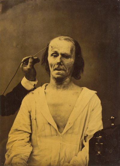 Zrelaksowana twarz po lewej, Głęboka uwaga po prawej, 1854-1856, wydruk 1862. autorstwa Duchenne de Boulogne