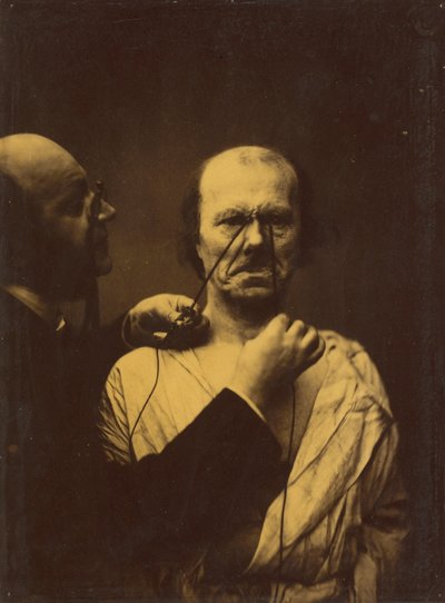Agresja, niegodziwość, 1854-1856, druk 1862. autorstwa Duchenne de Boulogne