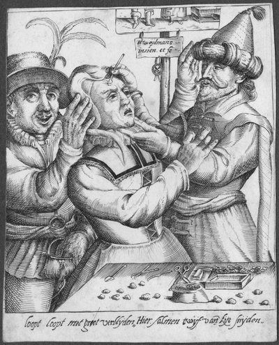 Trepanning, grawerowane przez H. Weydmansa (16 wieku) autorstwa Dutch School