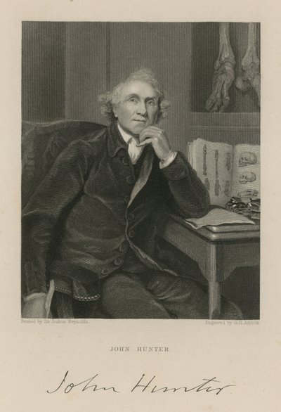 John Hunter autorstwa English School