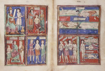 Sloane 1975 fol.91v-92 Sceny medyczne autorstwa English School