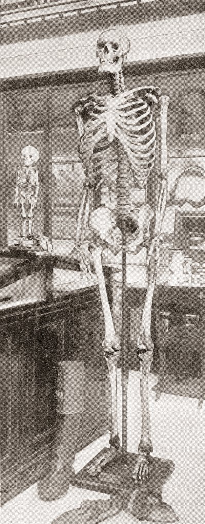 Szkielety Charlesa Byrne