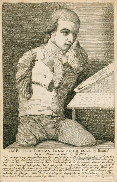 Thomas Inglefield, urodzony 18 grudnia 1769 w Hook, Hampshire, bez rąk i nóg autorstwa English School