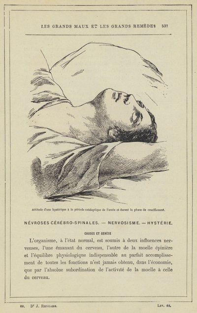 Postawa histeryka w okresie kataleptycznym dostępu i w fazie ukrzyżowania (litografia kolorowa) autorstwa French School