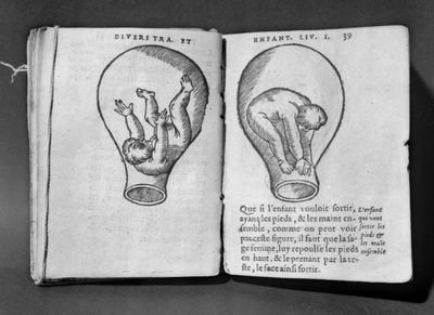 Płód w łonie matki, ilustracja z tzw. rękopisu Rodion autorstwa French School