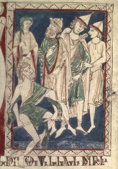 Fr.15307 f.1v Praca drapiąca swoje wrzody autorstwa French School