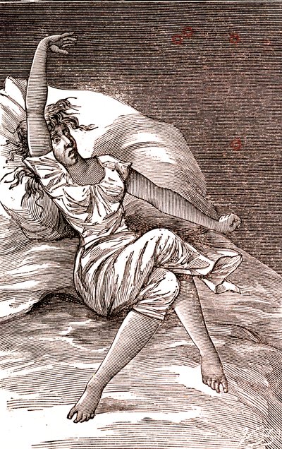 Bóle głowy, melankolia i histeria, niepokój. 1887 (grawerowanie) autorstwa French School