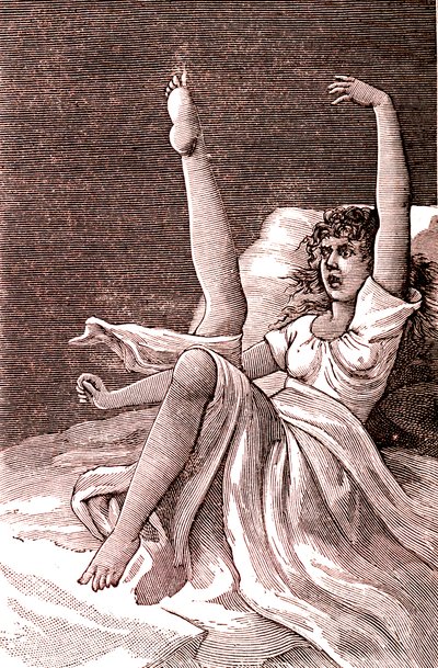 Histeria, zjawisko skrajnie psychiczne, psychozy i psychonerwice.1887 (ryc.) autorstwa French School