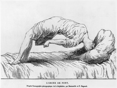 Histeria i somnambulizm, z Les Maladies Epidemiques de lEsprit Paula Regnarda (1850-1927) 1884 autorstwa French School