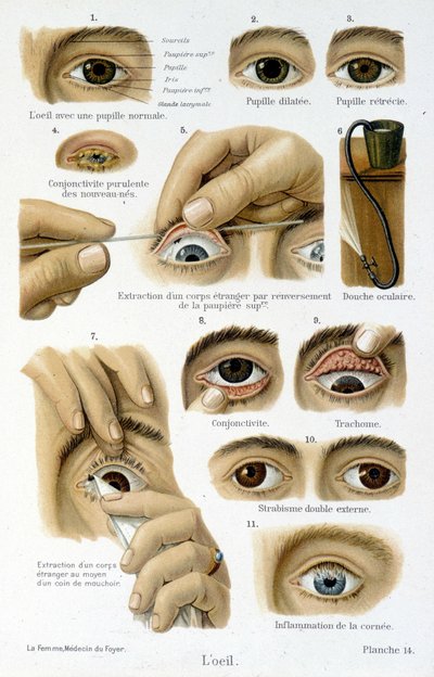 Medycyna: oko. autorstwa French School